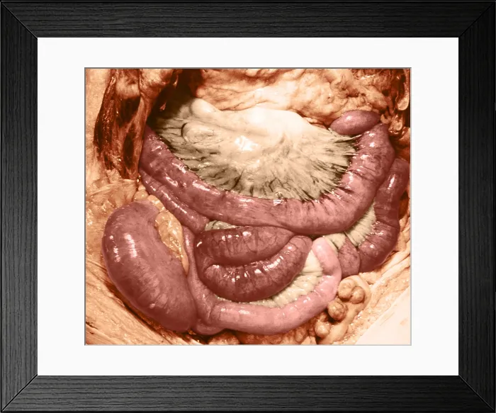 Framed Print : Intestines Framed Print : Intestines