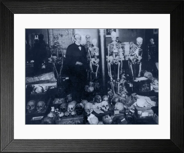 Framed Print : Rudolph Virchow, German Pathologist Framed Print : Rudolph Virchow, German Pathologist