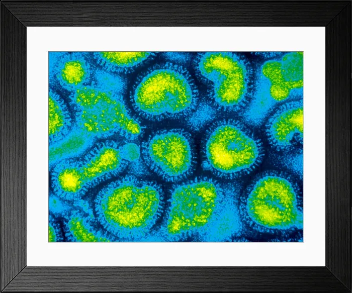 Framed Print : Influenza (TEM) Framed Print : Influenza (TEM)