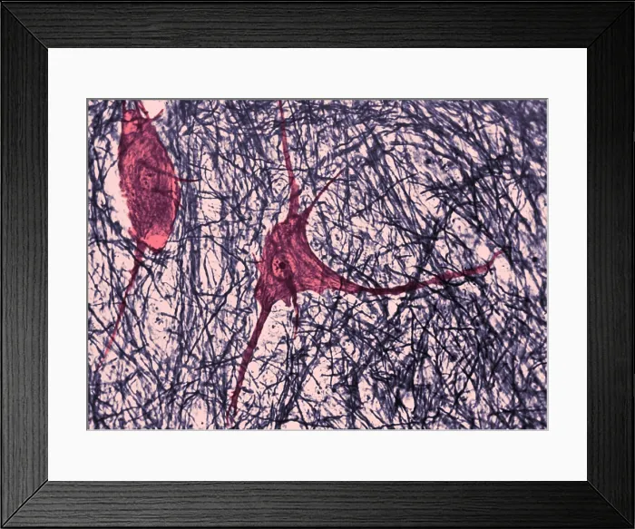 Framed Print : Motor Neuron, TEM Framed Print : Motor Neuron, TEM