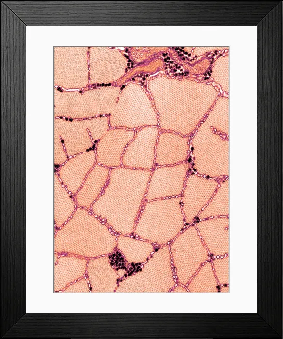 Framed Print : Smooth Muscle, Phasic, TEM Framed Print : Smooth Muscle, Phasic, TEM