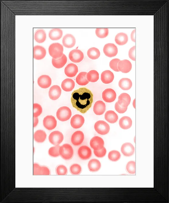 Framed Print : Genetics, Inactive X Chromosome, Drumstick, light micrograph Framed Print : Genetics, Inactive X Chromosome, Drumstick, light micrograph
