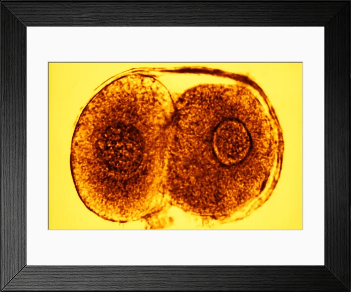 Framed Print : Human Reproduction, Ovum, Zygote Cell Stage, TEM
