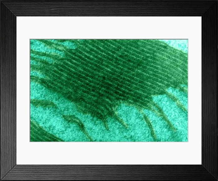 Framed Print : Chloroplast, TEM Framed Print : Chloroplast, TEM