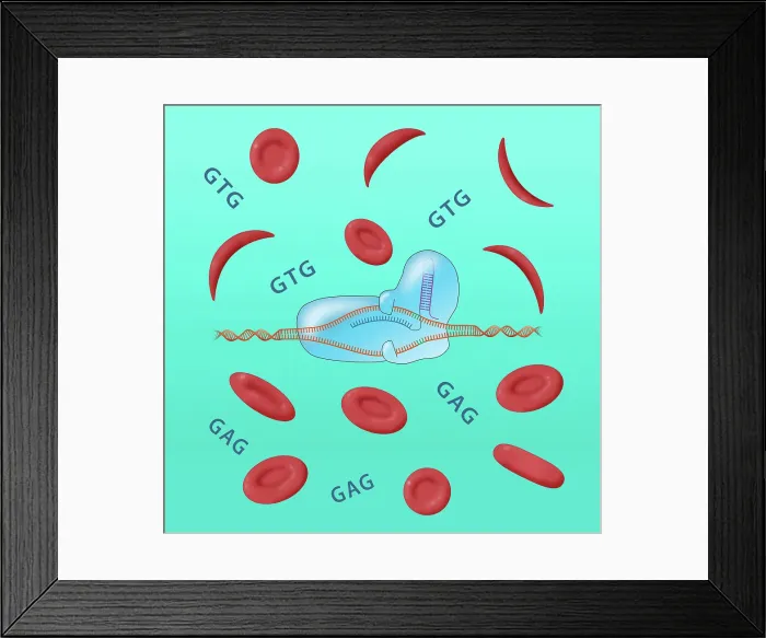 Framed Print : CRISPR cure for Sickle cell anemia disease and Normal Blood Cells, gtg, gag, Conceptual Illustration