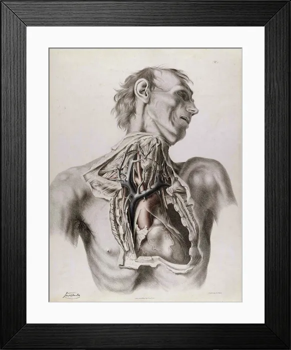 Framed Print : Historical Anatomical Illustration Framed Print : Historical Anatomical Illustration