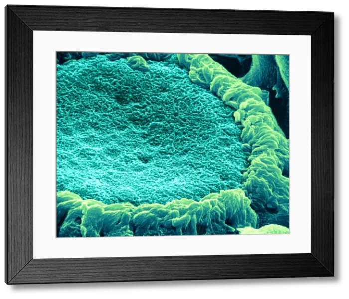 Framed Print : Papilla of frog's tongue, under a microscope (SEM) Framed Print : Papilla of frog's tongue, under a microscope (SEM)