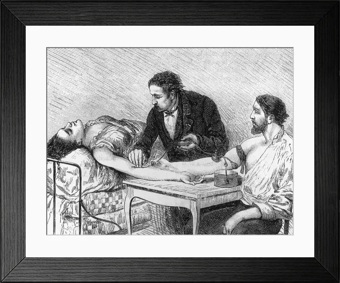 Framed Print : Blood Transfusion, 1882