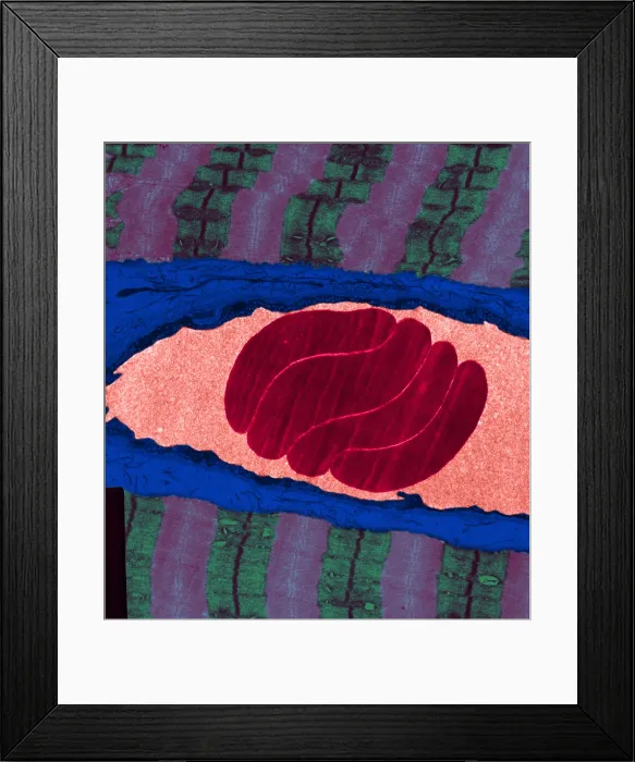 Framed Print : Erythrocytes, Capillary, Muscle Fibers, TEM Framed Print : Erythrocytes, Capillary, Muscle Fibers, TEM