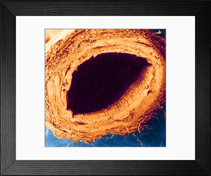 Framed Print : Healthy Vein, under a microscope (SEM) Framed Print : Healthy Vein, under a microscope (SEM)