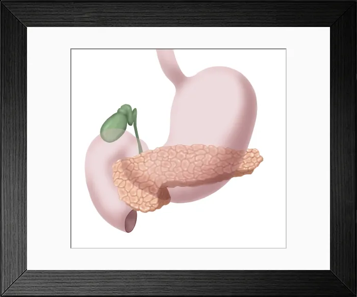 Framed Print : Pancreas, Gallbladder and Stomach