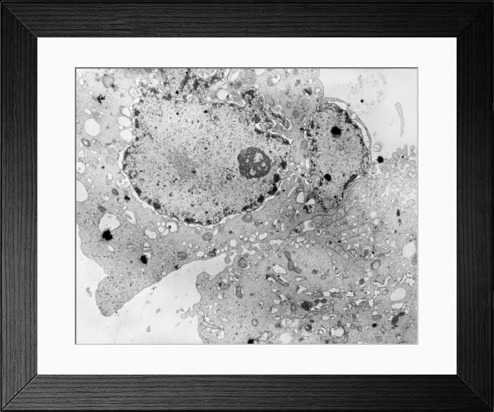 Framed Print : Cell Death, TEM