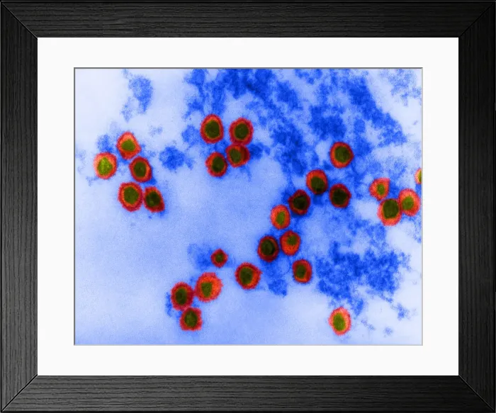 Framed Print : Rauscher Leukemia Virus, TEM