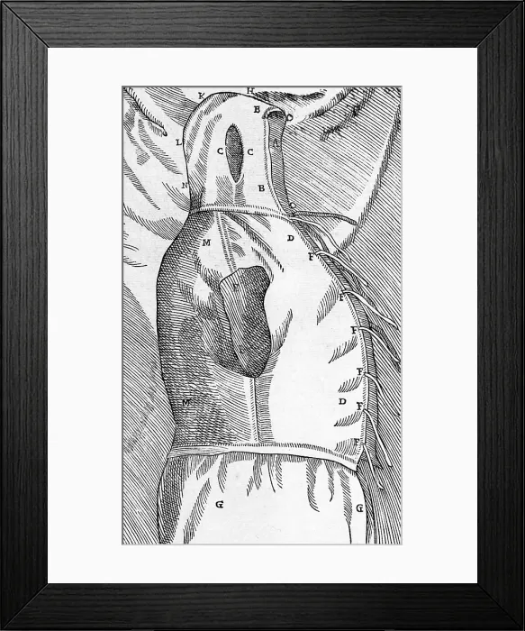 Framed Print : Equipment for One of Tagliacozzi's Rhinoplasty Methods Framed Print : Equipment for One of Tagliacozzi's Rhinoplasty Methods