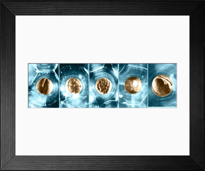 Framed Print : Frog Eggs. Color enhanced image of frog eggs (Ovum) at different stages of growth Framed Print : Frog Eggs. Color enhanced image of frog eggs (Ovum) at different stages of growth