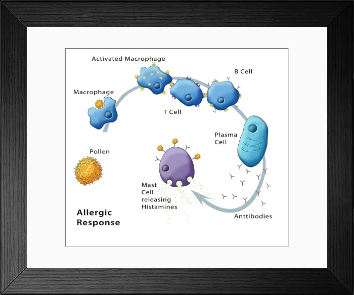 Framed Print : Allergic Response, Illustration Framed Print : Allergic Response, Illustration
