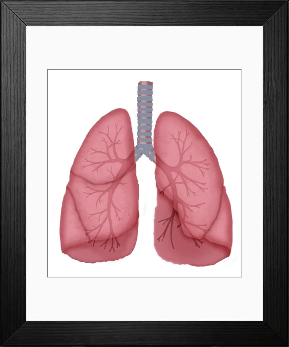 Framed Print : Normal lungs Framed Print : Normal lungs