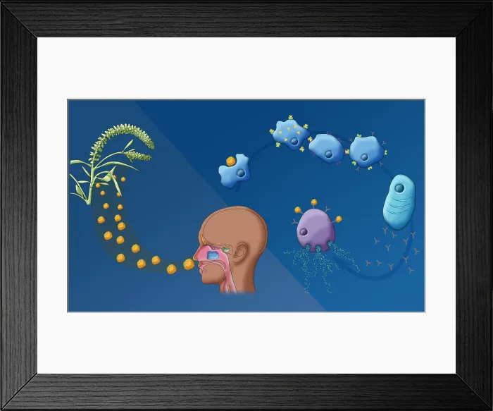 Framed Print : Ragweed Allergy, Illustration Framed Print : Ragweed Allergy, Illustration