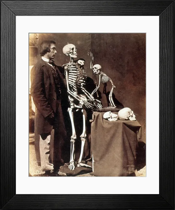 Framed Print : Reginald Southey, English Physician Framed Print : Reginald Southey, English Physician