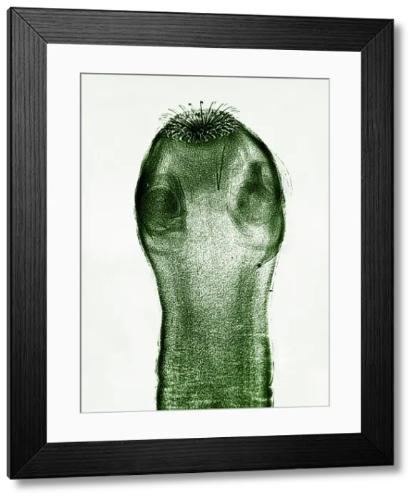 Framed Print : Dog Tapeworm Scolex, light micrograph Framed Print : Dog Tapeworm Scolex, light micrograph