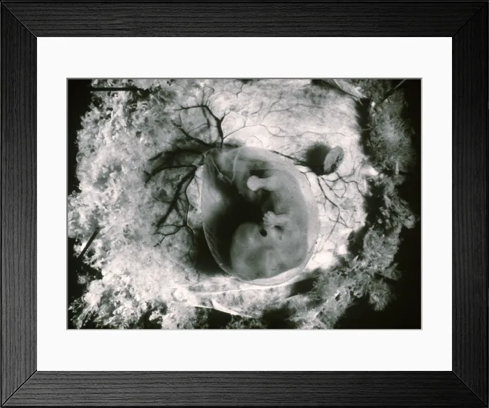 Framed Print : Human Embryo