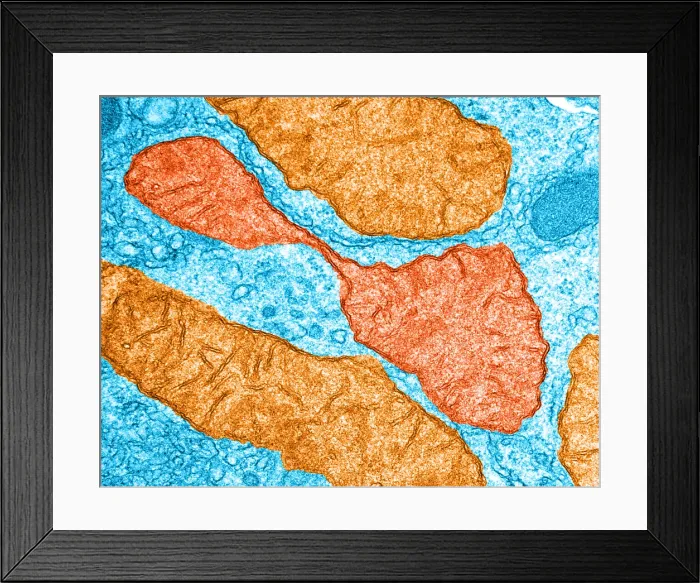 Framed Print : Hepatocyte, Dividing Mitochondrion, TEM