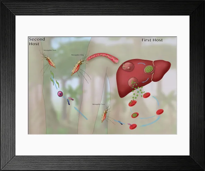 Framed Print : Malaria Cycle, Mosquitoes and Liver, Illustration Framed Print : Malaria Cycle, Mosquitoes and Liver, Illustration