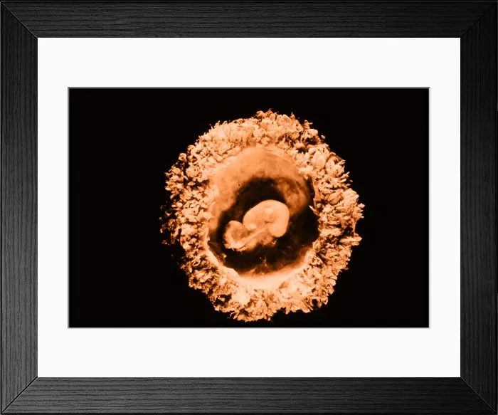 Framed Print : Human embryo Framed Print : Human embryo
