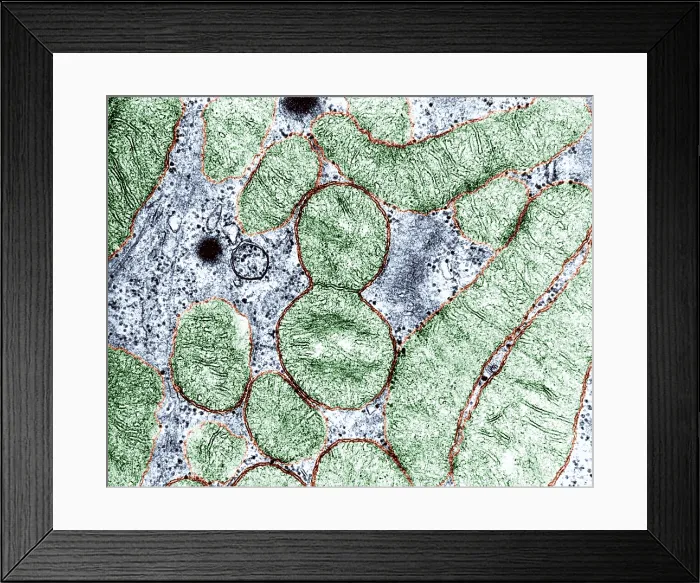 Framed Print : Dividing Mitochondrion, TEM Framed Print : Dividing Mitochondrion, TEM