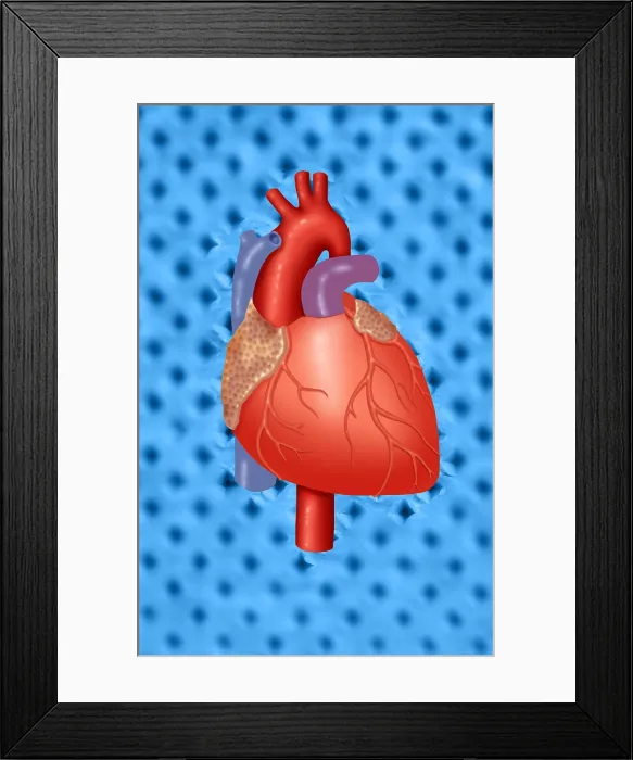 Framed Print : Human Heart Framed Print : Human Heart