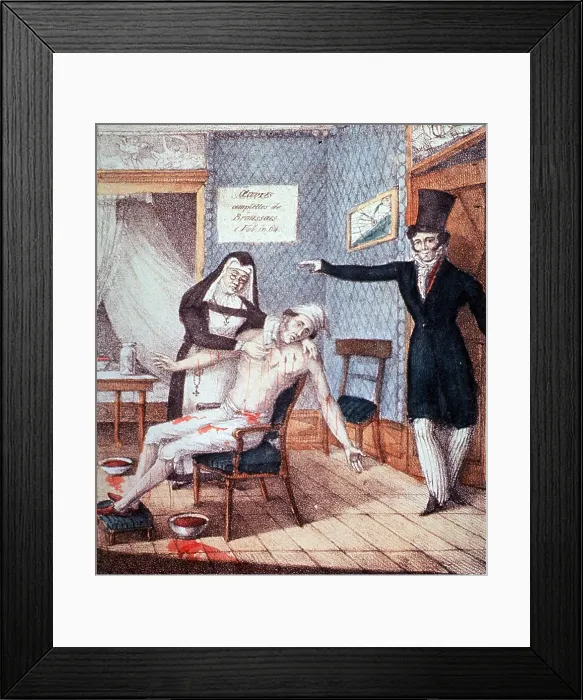 Framed Print : Francois Joseph Victor Broussais, French Physician Framed Print : Francois Joseph Victor Broussais, French Physician