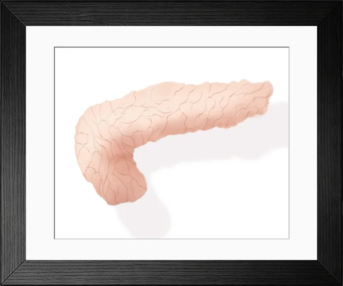 Framed Print : Pancreas Illustration