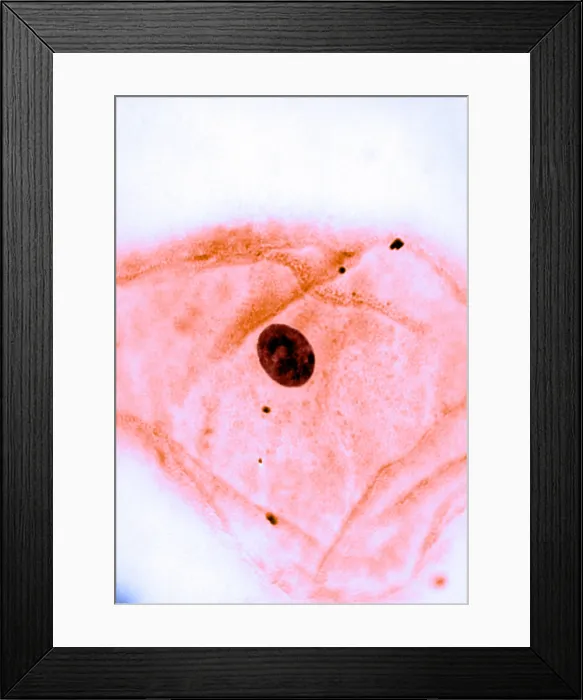 Framed Print : Genetics, Barr Body, light micrograph Framed Print : Genetics, Barr Body, light micrograph