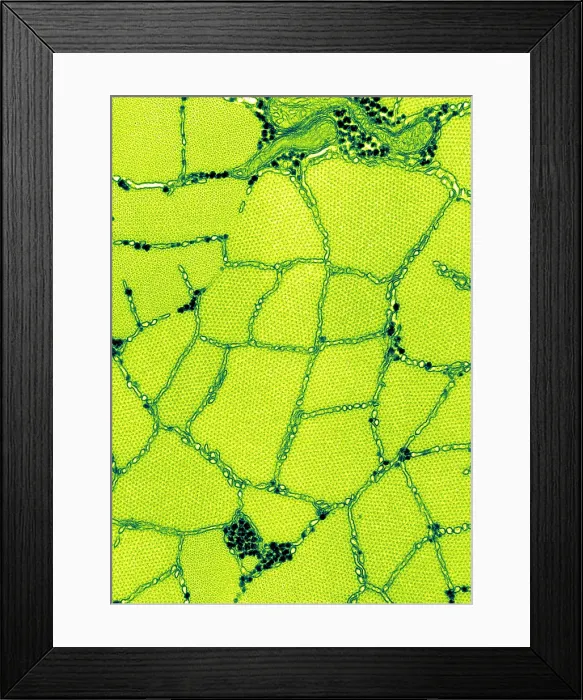 Framed Print : Smooth Muscle, Phasic, TEM Framed Print : Smooth Muscle, Phasic, TEM