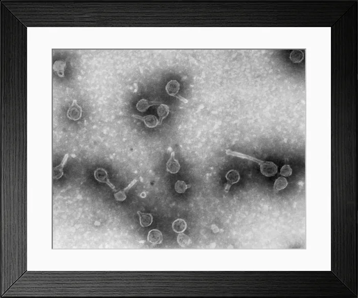 Framed Print : Rauscher Leukemia Virus Framed Print : Rauscher Leukemia Virus