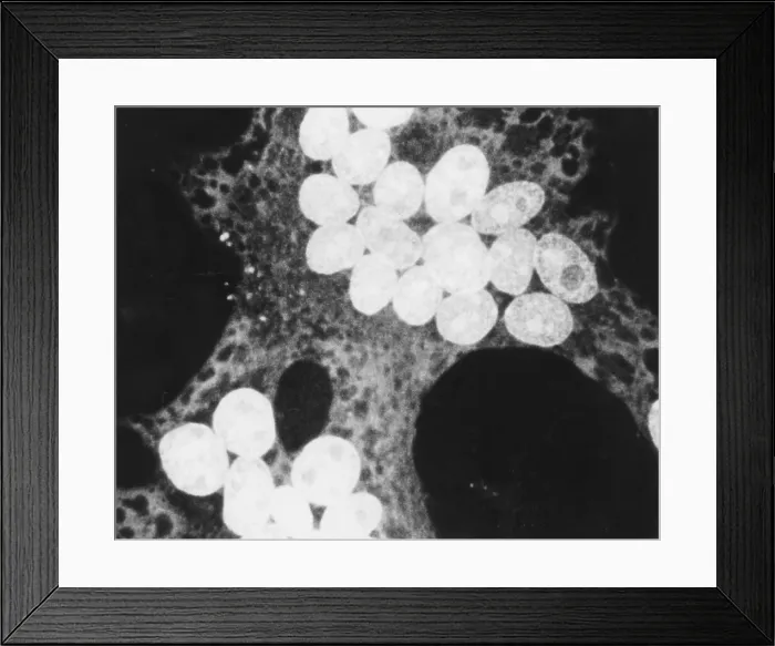 Framed Print : MeV, Measles Virus, TEM
