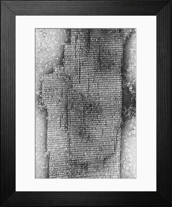 Framed Print : Catalase enzyme, TEM