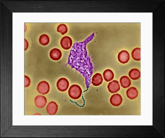Framed Print : Phagocytosis, WBC Ingesting Streptococcus, light micrograph