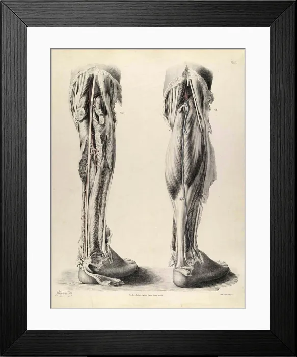 Framed Print : Historical Anatomical Illustration Framed Print : Historical Anatomical Illustration