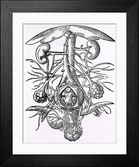 Framed Print : Pregnancy, 16th century artwork Framed Print : Pregnancy, 16th century artwork