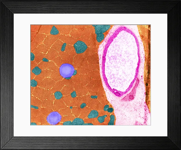 Framed Print : Cat Soleus Muscle, TEM