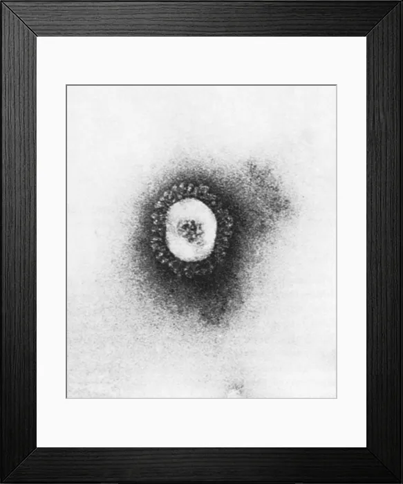 Framed Print : Coronavirus, TEM Framed Print : Coronavirus, TEM
