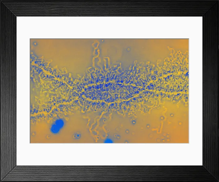 Framed Print : Lampbrush Chromosome Framed Print : Lampbrush Chromosome
