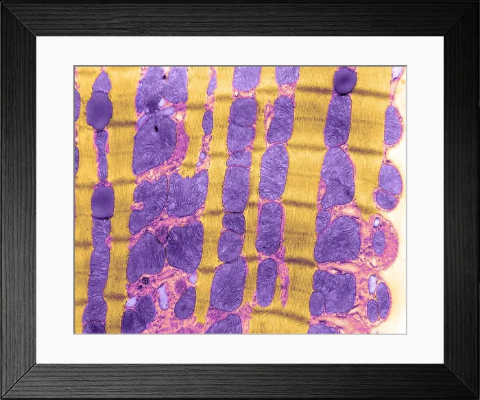 Framed Print : Cardiac Muscle, TEM Framed Print : Cardiac Muscle, TEM