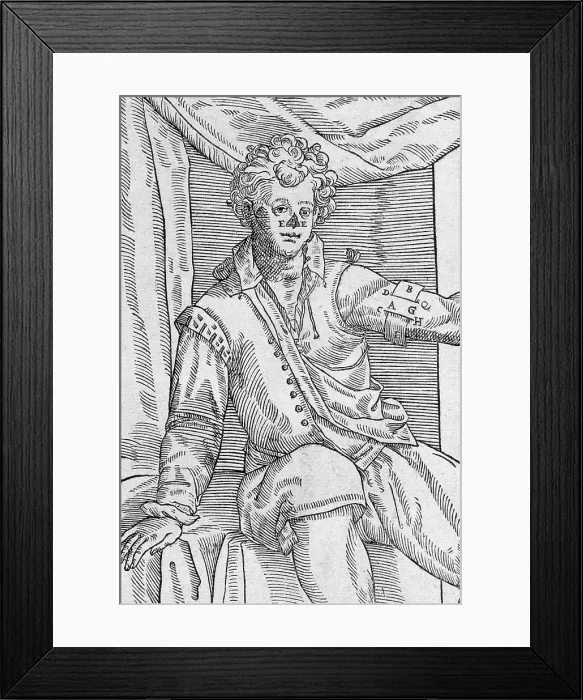 Framed Print : One of Tagliacozzi's Rhinoplasty Methods, 2 of 6 Framed Print : One of Tagliacozzi's Rhinoplasty Methods, 2 of 6