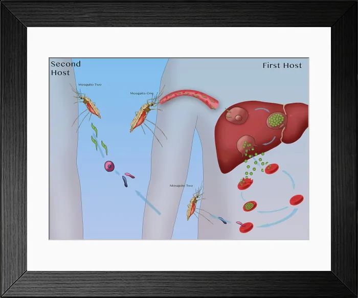 Framed Print : Malaria Cycle, Mosquitoes and Liver, Illustration Framed Print : Malaria Cycle, Mosquitoes and Liver, Illustration