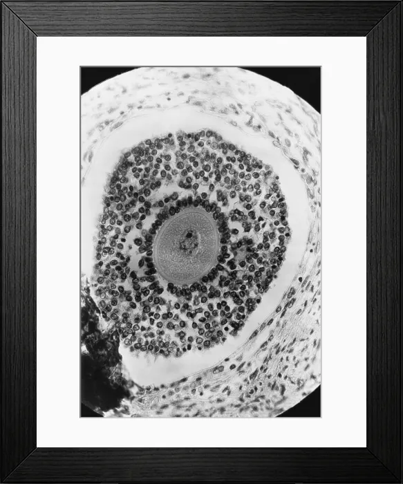 Framed Print : Human Reproduction, Ovum, light micrograph