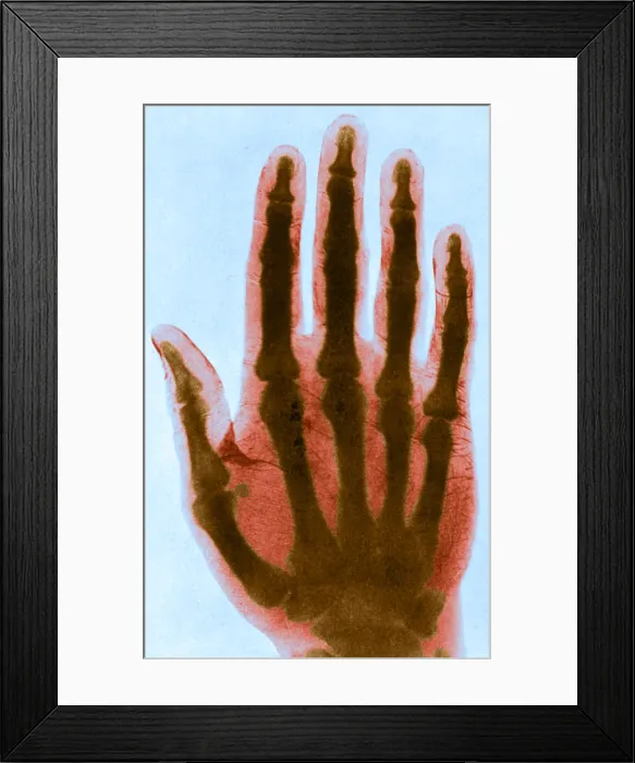 Framed Print : Early X-ray Framed Print : Early X-ray