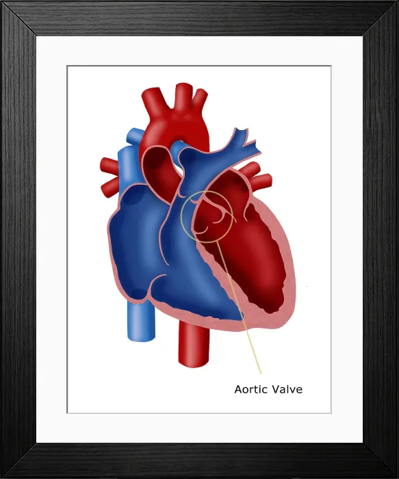 Framed Print : Aortic Valve Framed Print : Aortic Valve