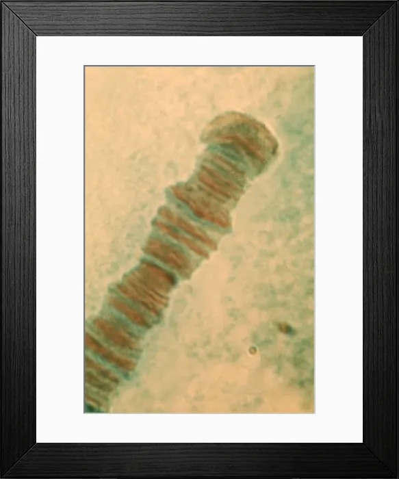 Framed Print : Ecdysone and larval puffing Framed Print : Ecdysone and larval puffing